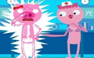 带你了解激光除疤 飞碟一分钟 310